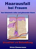 E-Book (epub) Haarausfall bei Frauen - Ursachen und Behandlung - Das Geheimnis voller und glänzender Haare von Ulrich Zimmermann