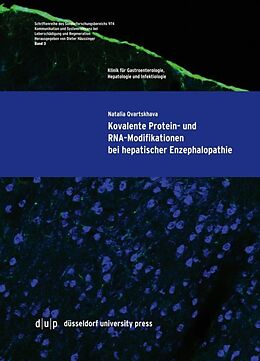 Kartonierter Einband Kovalente Protein- und RNA-Modifikationen bei hepatischer Enzephalopathie von Natalia Qvartskhava