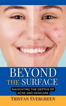 E-Book (epub) Beyond the Surface von Tristan Evergreen