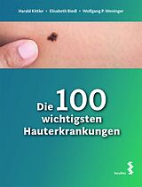 E-Book (pdf) Die 100 wichtigsten Hauterkrankungen von Harald Kittler, Elisabeth Riedl, Wolfgang P. Weninger