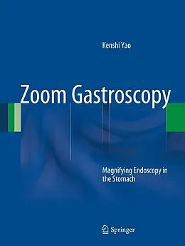 E-Book (pdf) Zoom Gastroscopy von Kenshi Yao