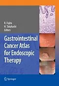 E-Book (pdf) Gastrointestinal Cancer Atlas for Endoscopic Therapy von Hiroshi Takahashi, Rikiya Fujita