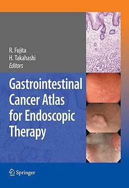 E-Book (pdf) Gastrointestinal Cancer Atlas for Endoscopic Therapy von Hiroshi Takahashi, Rikiya Fujita