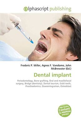 Couverture cartonnée Dental implant de 