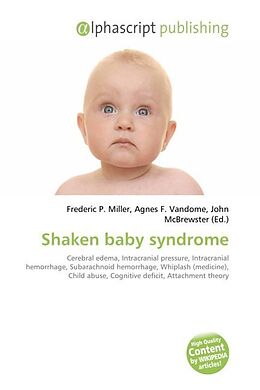 Couverture cartonnée Shaken baby syndrome de 