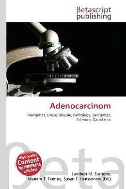 Kartonierter Einband Adenocarcinom von 