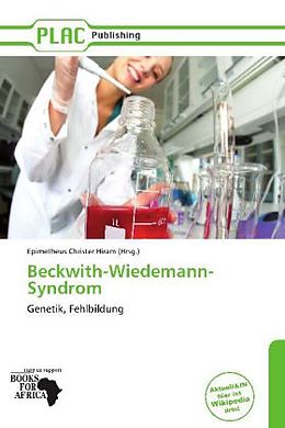 Kartonierter Einband Beckwith-Wiedemann-Syndrom von 