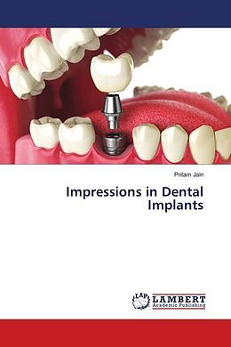 Kartonierter Einband Impressions in Dental Implants von Pritam Jain