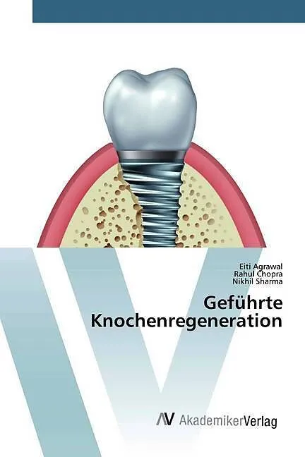 Geführte Knochenregeneration