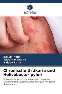 Kartonierter Einband Chronische Urtikaria und Helicobacter pylori von Sakshi Kohli, Vikram Mahajan, Baldev Rana