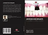 Kartonierter Einband LES ÉCHECS DES IMPLANTS von Akshay D. Joshi, Shweta A. Kolhe, Agrima Agrawal