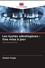Kartonierter Einband (Kt) Les kystes odontogènes : Une mise à jour von Shafali Singh
