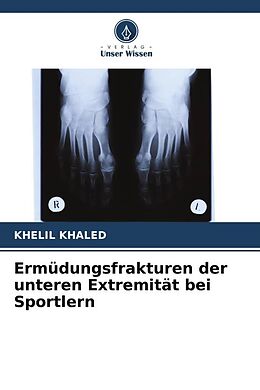 Kartonierter Einband Ermüdungsfrakturen der unteren Extremität bei Sportlern von Khelil Khaled