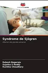 Kartonierter Einband Syndrome de Sjögren von Rakesh Nagaraju, Sujatha S Reddy, Ruchika Choudhary