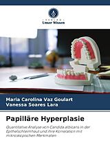 Kartonierter Einband Papilläre Hyperplasie von Maria Carolina Vaz Goulart, Vanessa Soares Lara