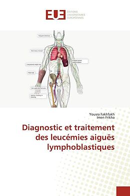 Kartonierter Einband Diagnostic et traitement des leucémies aiguës lymphoblastiques von Yousra Fakhfakh, Imen Frikha