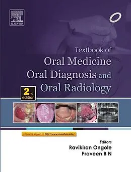 E-Book (epub) Textbook of Oral Medicine, Oral Diagnosis and Oral Radiology - E-Book von 