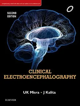 ePUB Clinical Electroencephalography E-book von U. K. Misra, J. Kalita