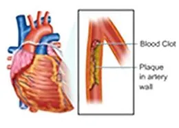 E-Book (epub) Estimation of Blood Triglycerides von Seema Shah