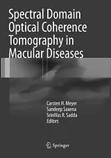 Kartonierter Einband Spectral Domain Optical Coherence Tomography in Macular Diseases von 