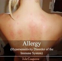 E-Book (pdf) Allergy (Hypersensitivity Disorder of the Immune System) von Jule Cosgrove
