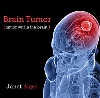 E-Book (pdf) Brain Tumor (tumor within the brain) von Janet Alger