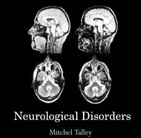 eBook (pdf) Neurological Disorders de Mitchel Talley