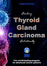 eBook (epub) Thyroid Gland Carcinoma de Lothar Hirneise