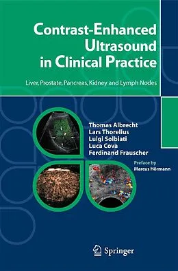 E-Book (pdf) Contrast-Enhanced Ultrasound in Clinical Practice von Thomas Albrecht, Lars Thorelius, Luigi Solbiati