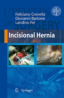 E-Book (pdf) Incisional Hernia von Feliciano Crovella, Giovanni Bartone, Landino Fei