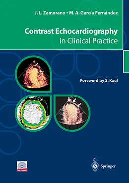 E-Book (pdf) Contrast Echocardiography in Clinical Practice von Jose L. Zamorano, Miguel A. García Fernández