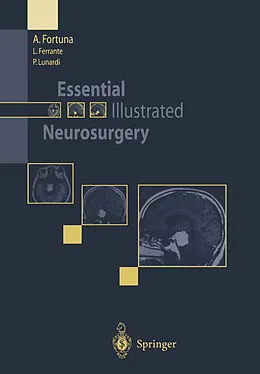 E-Book (pdf) Essential Illustrated Neurosurgery von A. Fortuna, L. Ferrante, P. Lunardi