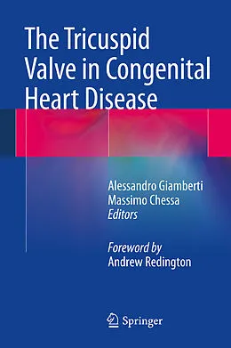 E-Book (pdf) The Tricuspid Valve in Congenital Heart Disease von Alessandro Giamberti, Massimo Chessa