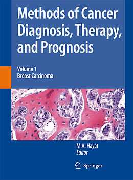 Couverture cartonnée Methods of Cancer Diagnosis, Therapy and Prognosis de 
