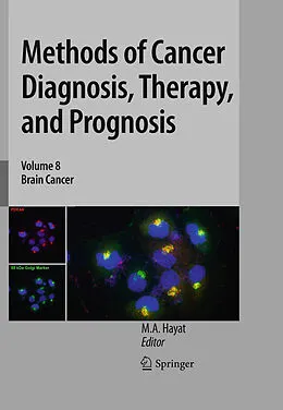 E-Book (pdf) Methods of Cancer Diagnosis, Therapy, and Prognosis von M. A. Hayat