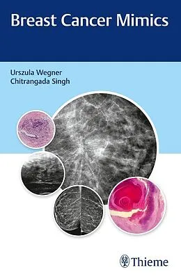 E-Book (epub) Breast Cancer Mimics von Urszula Wegner, Chitrangada Singh