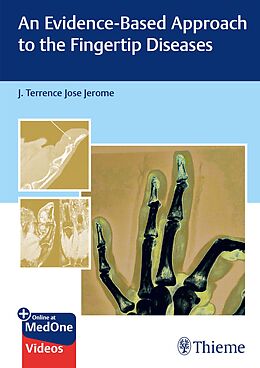  An Evidence-Based Approach to the Fingertip Diseases de 