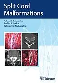 E-Book (epub) Split Cord Malformations von Ashok K. Mahapatra, Sachin A. Borkar, Subhashree Mahapatra