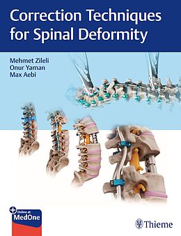E-Book (epub) Correction Techniques for Spinal Deformity von 