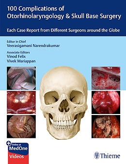  100 Complications of Otorhinolaryngology &amp; Skull Base Surgery de 