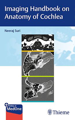  Imaging Handbook on Anatomy of Cochlea de Neeraj Suri