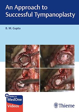  An Approach to Successful Tympanoplasty de B Gupta