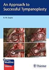eBook (pdf) An Approach to Successful Tympanoplasty de B. Gupta