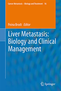 Livre Relié Liver Metastasis: Biology and Clinical Management de 