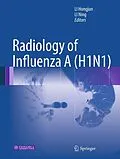E-Book (pdf) Radiology of Influenza A (H1N1) von Hongjun Li, Ning Li