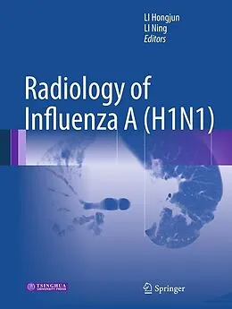 E-Book (pdf) Radiology of Influenza A (H1N1) von Hongjun Li, Ning Li