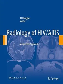 E-Book (pdf) Radiology of HIV/AIDS von Hongjun Li