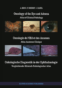 E-Book (pdf) Oncology of the Eye and Adnexa / Oncologie de lil et des Annexes / Onkologische Diagnostik in der Ophthalmologie von A. Brini, A. Dhermy, J. Sahel