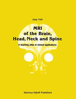 E-Book (pdf) MRI of the Brain, Head, Neck and Spine von Jaap Valk