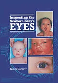 E-Book (pdf) Inspecting the Newborn Baby's Eyes von N. O'Doherty